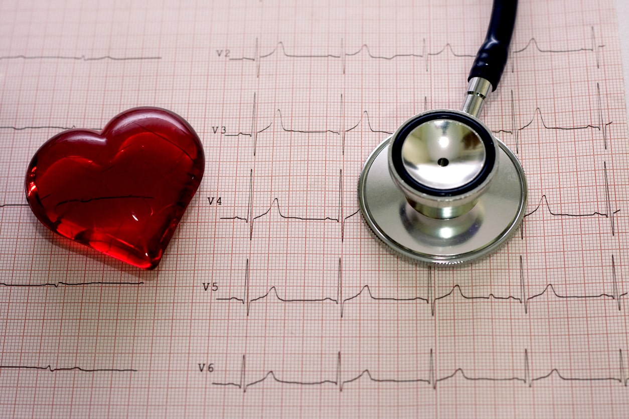 Check-up cardiológico